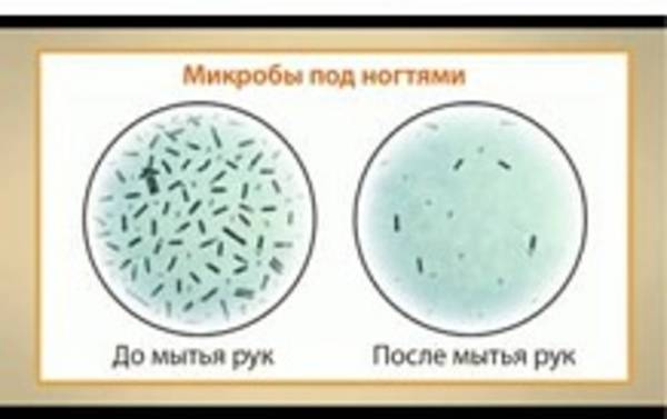 Вижу бактерии. Бактерии под ногтями под микроскопом. Под микроскопом грязные и чистые руки. Микробы под ногтями для детей. Руки под микроскопом до мытья и после.